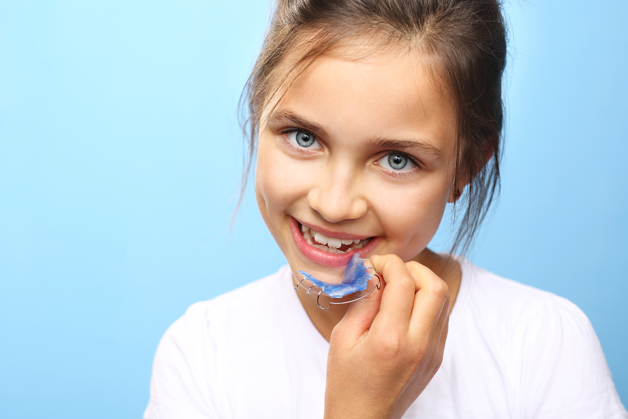 Qué tipos de ortodoncia hay y cuál elegir