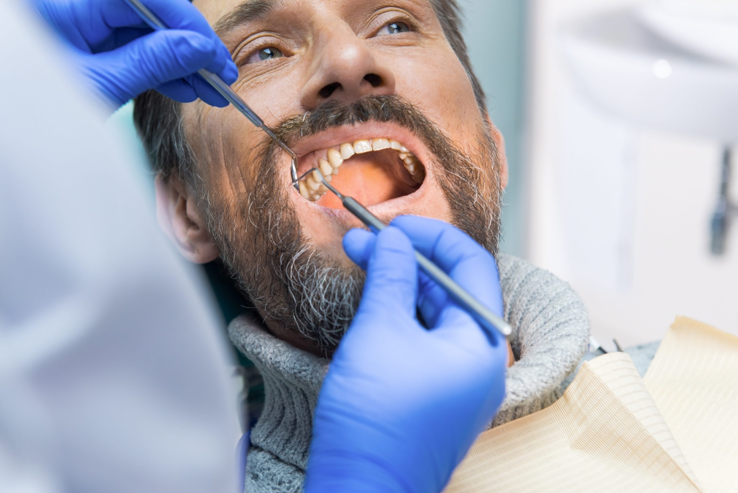 Estas son las enfermedades dentales más comunes en adultos