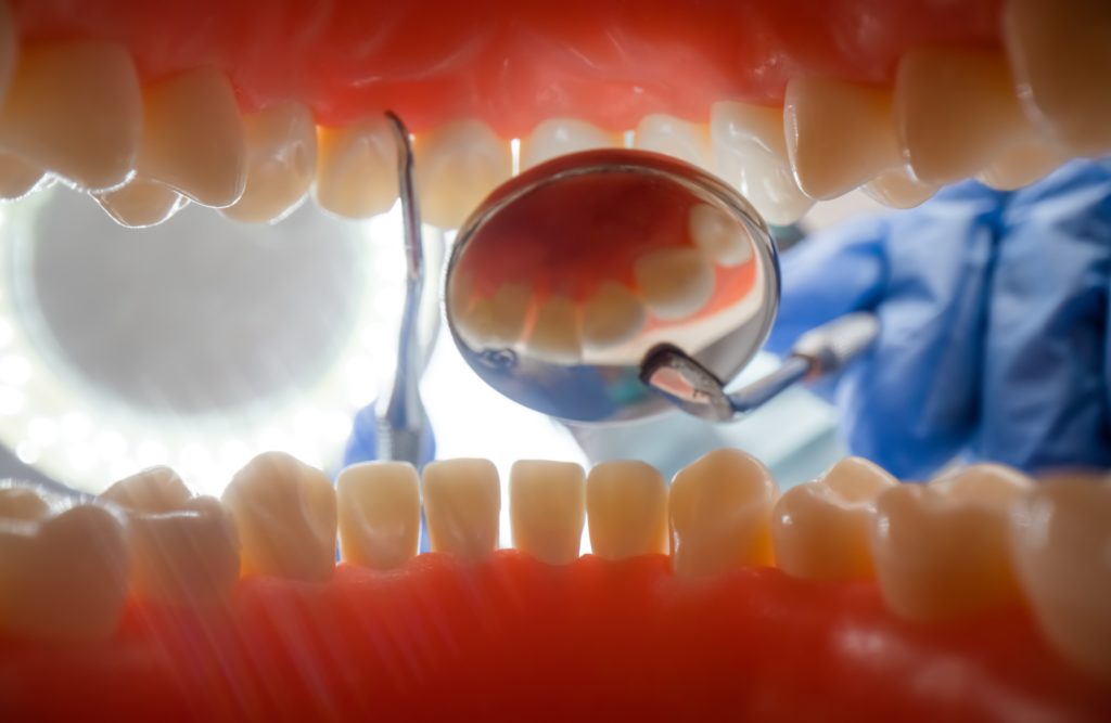Trata y prevén la erosión dental