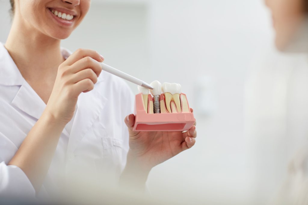 Implantología dental inmediata