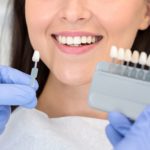 Blanqueamiento dental en Morales Cervera