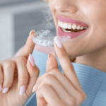 Importancia de los retenedores tras la ortodoncia