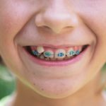 Qué debes saber sobre una ortodoncia infantil