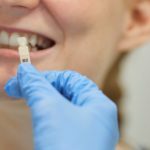 implantes dentales