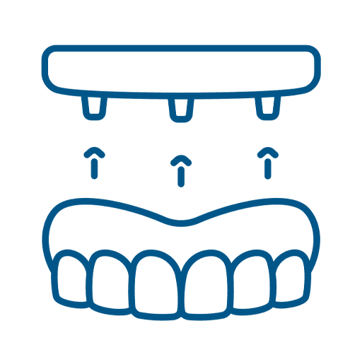 Colocación de la prótesis definitiva