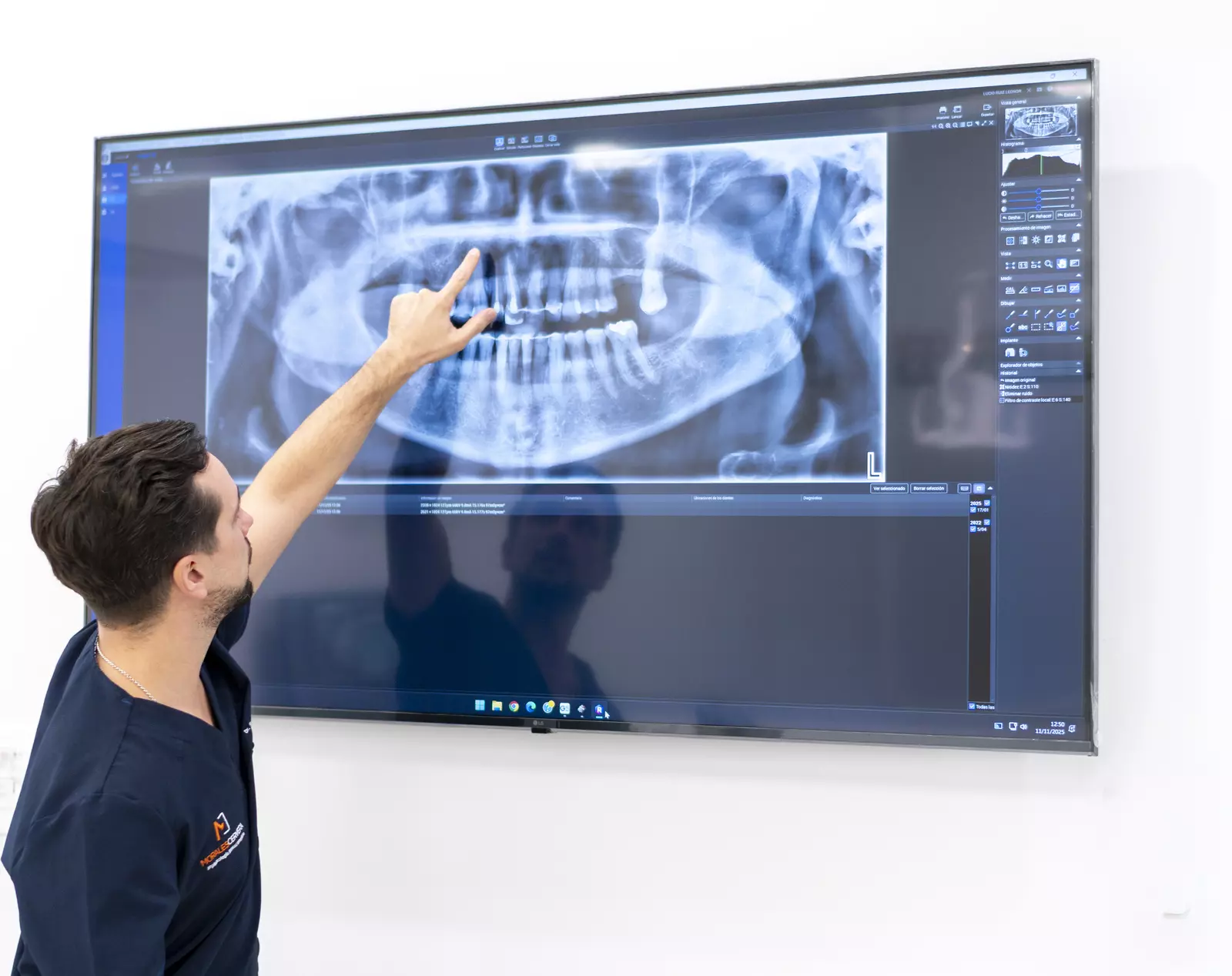 Dr. Jose Cervera con radiografía de implantes — Morales Cervera