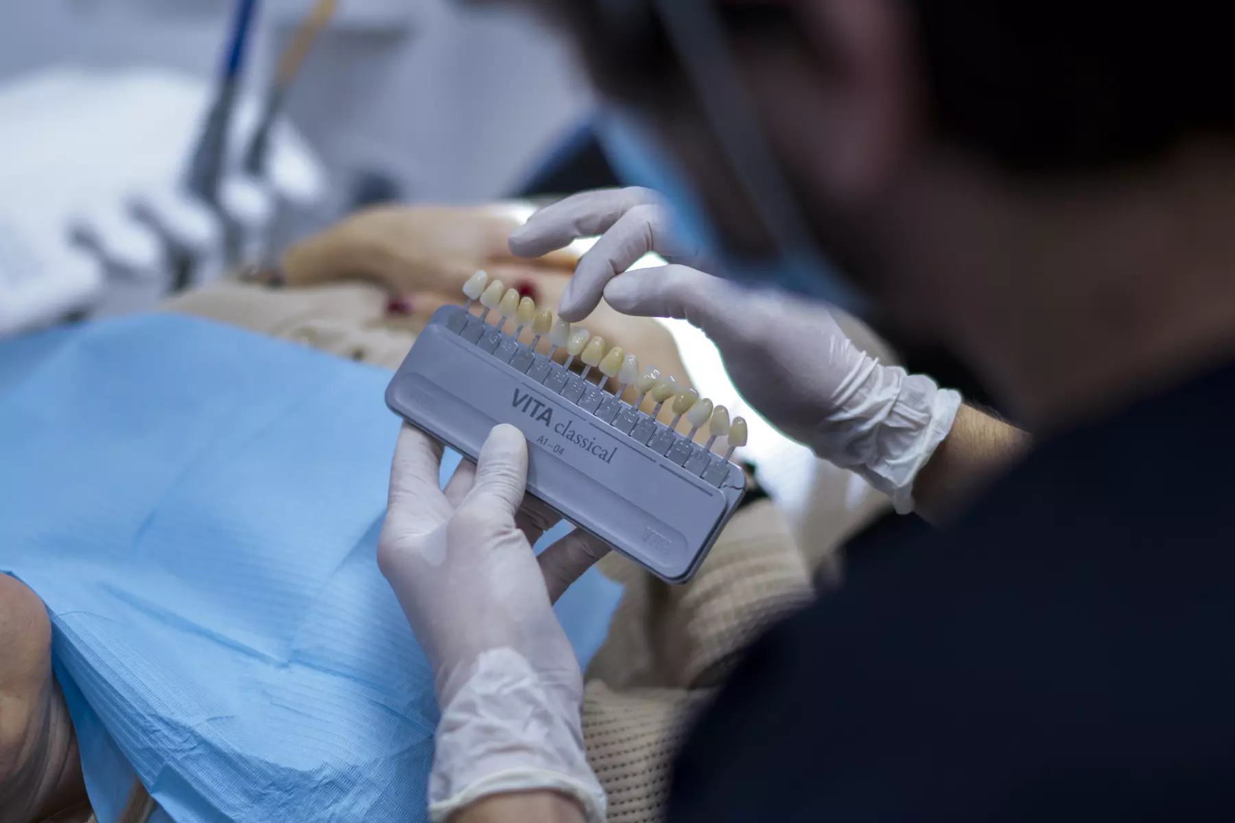 Estética dental con paciente en clínica Morales Cervera