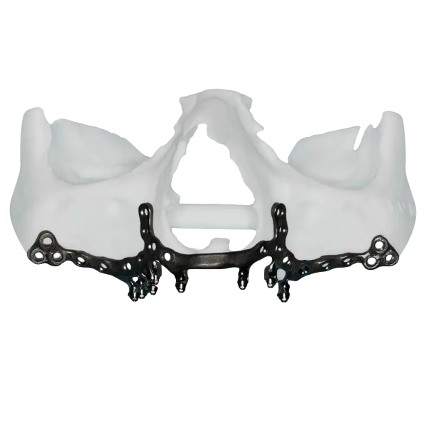 Malla de Integración Ósea — Morales Cervera